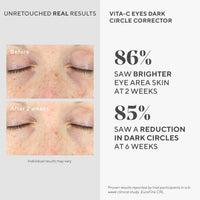 Thumbnail for Murad Vita-C Eyes Dark Circle Corrector – Gold-Stabilized Vitamin C, Algae, and Cucumber Eye Serum for Brightening, Reducing Puffiness, and Smoothing Fine Lines – 0.5 Fl Oz