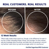 Thumbnail for Sugarbear Hair Vitamin Gummy 2 Month Supply Extra Strength Biotin 6000mcg, Growth for Men & Women, Vegan Vitamin B12, MSM, Inositol, Omega 3, Elderberry, Certified Kosher, Halal, Cruelty-Free