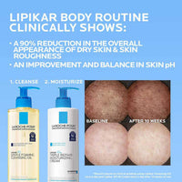 Thumbnail for La Roche-Posay Lipikar AP+ Gentle Foaming Cleansing Oil, Gentle Oil Cleanser for Face and Body Formulated with Niacinamide, Long-Lasting 24-hour Hydration, Fragrance-Free & Soap Free