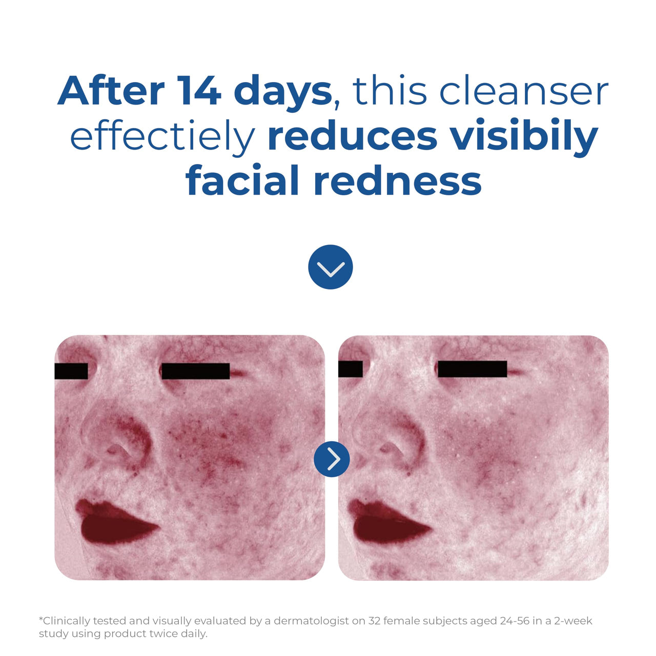 EltaMD Skin Recovery Amino Acid Foaming Cleanser, Gentle Face Cleanser for Sensitive Skin, Proven to Gently Remove Makeup and Sunscreen,Fragrance Free and Noncomedogenic, Foaming Face Wash, 5 oz
