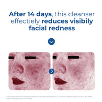 Thumbnail for EltaMD Skin Recovery Amino Acid Foaming Cleanser, Gentle Face Cleanser for Sensitive Skin, Proven to Gently Remove Makeup and Sunscreen,Fragrance Free and Noncomedogenic, Foaming Face Wash, 5 oz