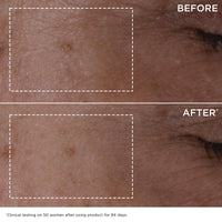 Thumbnail for Clarins DOUBLE SERUM | Anti Aging Face Serum | Visibly Firms, Smoothes, Boosts Radiance, and Refines Pores | 24H Hydration | All Skin Types, 1 Fl Oz