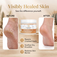 Thumbnail for Vitality Extracts Frankincense Balm - 2oz, Boswellia Serrata, Beeswax, Olive Oil, Moisturizer for Dry, Cracked Skin, All Skin Types