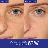 Thumbnail for Caudalie Vinoperfect Brightening Dark Spot Serum Vitamin C Alternative - 62x More Effective than Vitamin C with Viniferine for a Visibly Brighter Even Complexion, 30 mL