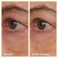 Thumbnail for Beekman 1802 Mushroom Goat Milk Eye Cream - Clinically Proven Anti-Aging Eye Treatment for Dark Circles & Fine Lines - With Kojic Acid, Hexapeptide & Mushrooms - Fragrance-Free, Cruelty-Free