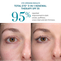 Thumbnail for Colorescience Total Eye 3-in-1 Renewal Therapy, 0.23 Fl Oz, Medium