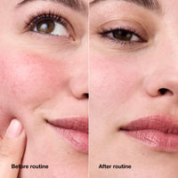 Thumbnail for Clinique Redness Solutions Daily Relief Cream with Microbiome Technology, 1.7 Fl Oz