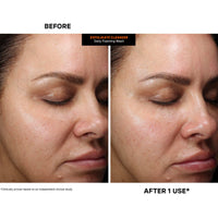 Thumbnail for Kate Somerville ExfoliKate Cleanser – Daily Exfoliating Foaming Face Wash, Clinically Formulated Glycolic Acid and Lactic Acid Gentle Facial Scrub, 4 Fl Oz