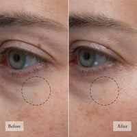 Thumbnail for philosophy hope in a jar skincare essentials mini set