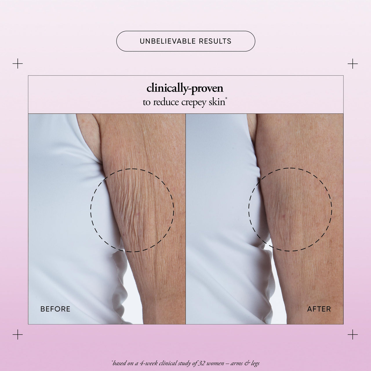 philosophy ultimate miracle worker resurfacing body serum - with retinol, hyaluronic acid & peptides - clinically proven to immediately double skin's moisture and reduce crepiness - 6.5 fl oz