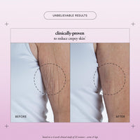 Thumbnail for philosophy ultimate miracle worker resurfacing body serum - with retinol, hyaluronic acid & peptides - clinically proven to immediately double skin's moisture and reduce crepiness - 6.5 fl oz