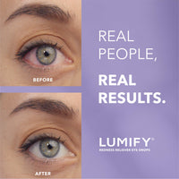 Thumbnail for LUMIFY Eye Drops for Red Eyes, Redness Reliever for Brighter Looking Eyes, Works in 1 Minute & Lasts Up to 8 Hours, Eye Drops, 0.08 Fl Oz (2.5 mL)