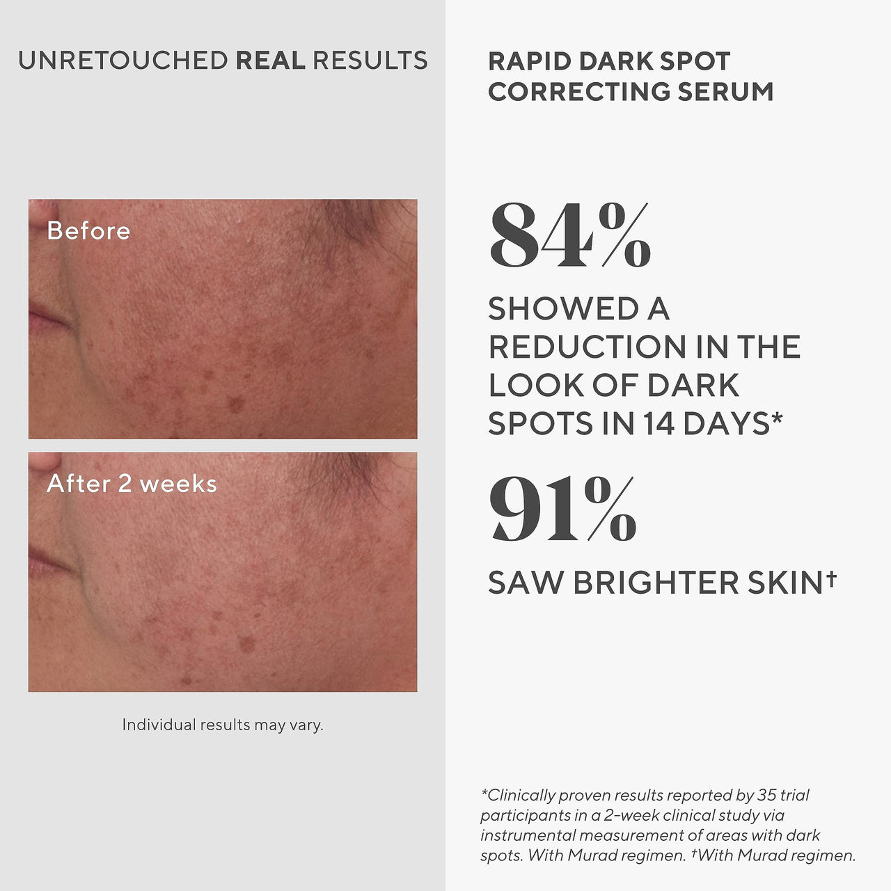 Murad Rapid Dark Spot Correcting Serum - Advanced Anti-Aging Formula with Patented Resorcinol Technology, Tranexamic and Glycolic Acids for Hyperpigmentation, Dark Spots and Dull Skin - 1 Fl Oz