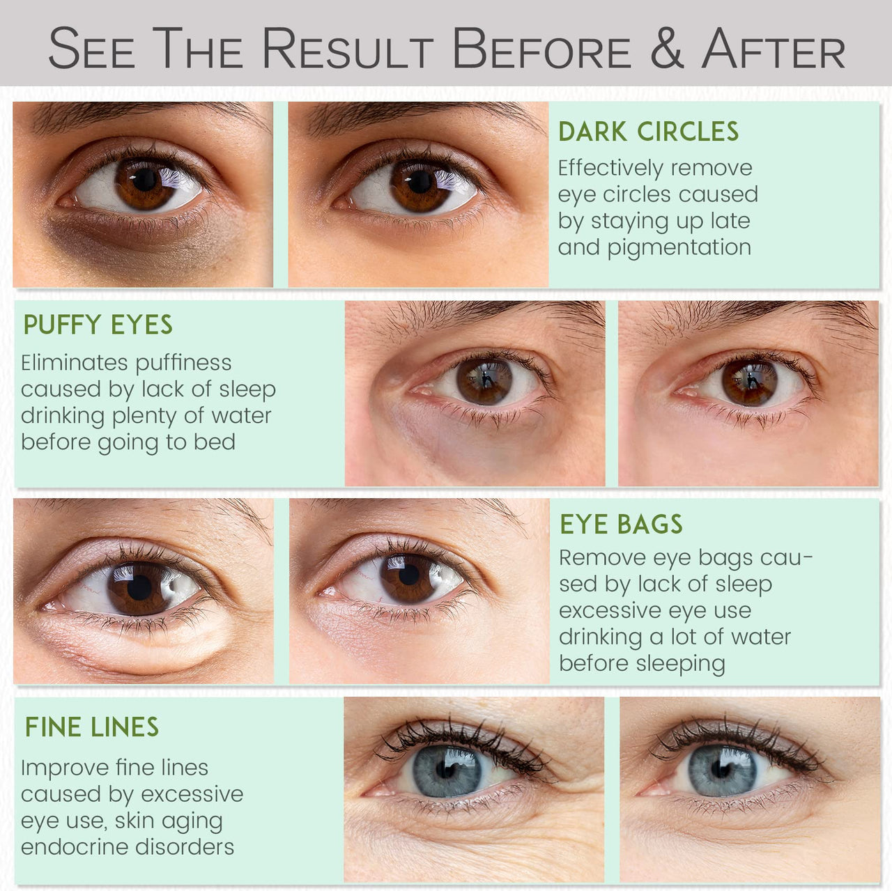 NAZANO Under Eye Patches for Dark Circles and Puffiness - Under Eye Masks Anti-Aging Collagen Hyaluronic Acid, Reduce Dark Circles & Wrinkles Skincare Beauty Products for Self Care (30 Pairs) 2