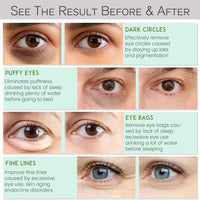 Thumbnail for NAZANO Under Eye Patches for Dark Circles and Puffiness - Under Eye Masks Anti-Aging Collagen Hyaluronic Acid, Reduce Dark Circles & Wrinkles Skincare Beauty Products for Self Care (30 Pairs) 2