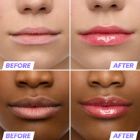 Thumbnail for Wonderskin Lip Oil Rehab Serum - Tinted Lip Oil for Women, Hydrating, Moisturizing, and Non-Sticky Red Tint Serum for Dry Lips (Amour)