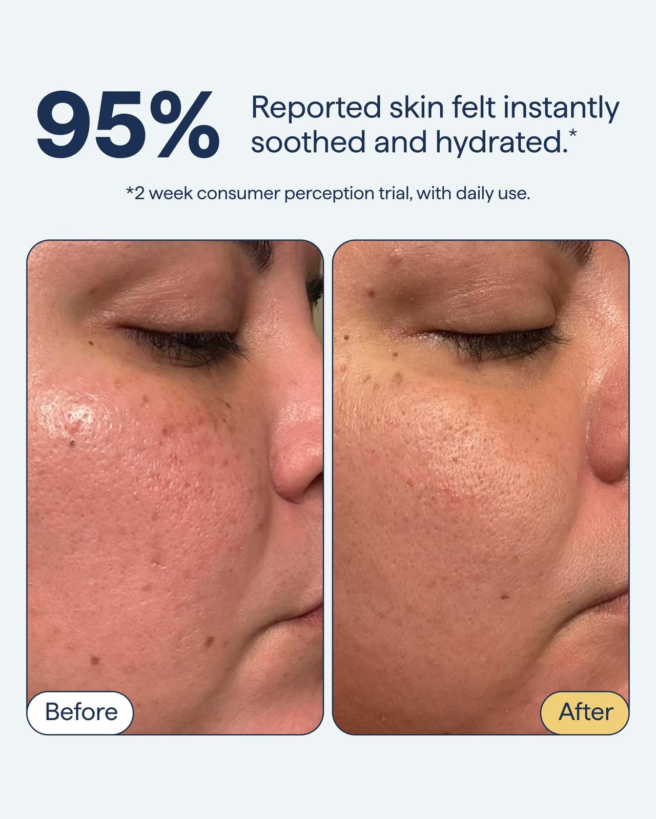 Remedy for Light Moisture | Barrier Repairing Hydrating Lightweight Gel Moisturizer Water Cream for Normal to Oily Skin | By Dermatologist Dr. Shah, 1.7 fl. Oz
