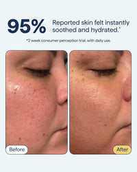 Thumbnail for Remedy for Light Moisture | Barrier Repairing Hydrating Lightweight Gel Moisturizer Water Cream for Normal to Oily Skin | By Dermatologist Dr. Shah, 1.7 fl. Oz