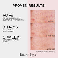 Thumbnail for BellamiLuxx Butt Acne Clearing Treatment Cream: Body Acne Treatment for Folliculitis and Pimples on Buttocks, Thighs, and Body with 2% Salicylic Acid & Tea Tree Oil - Butt Cream for Smooth Skin