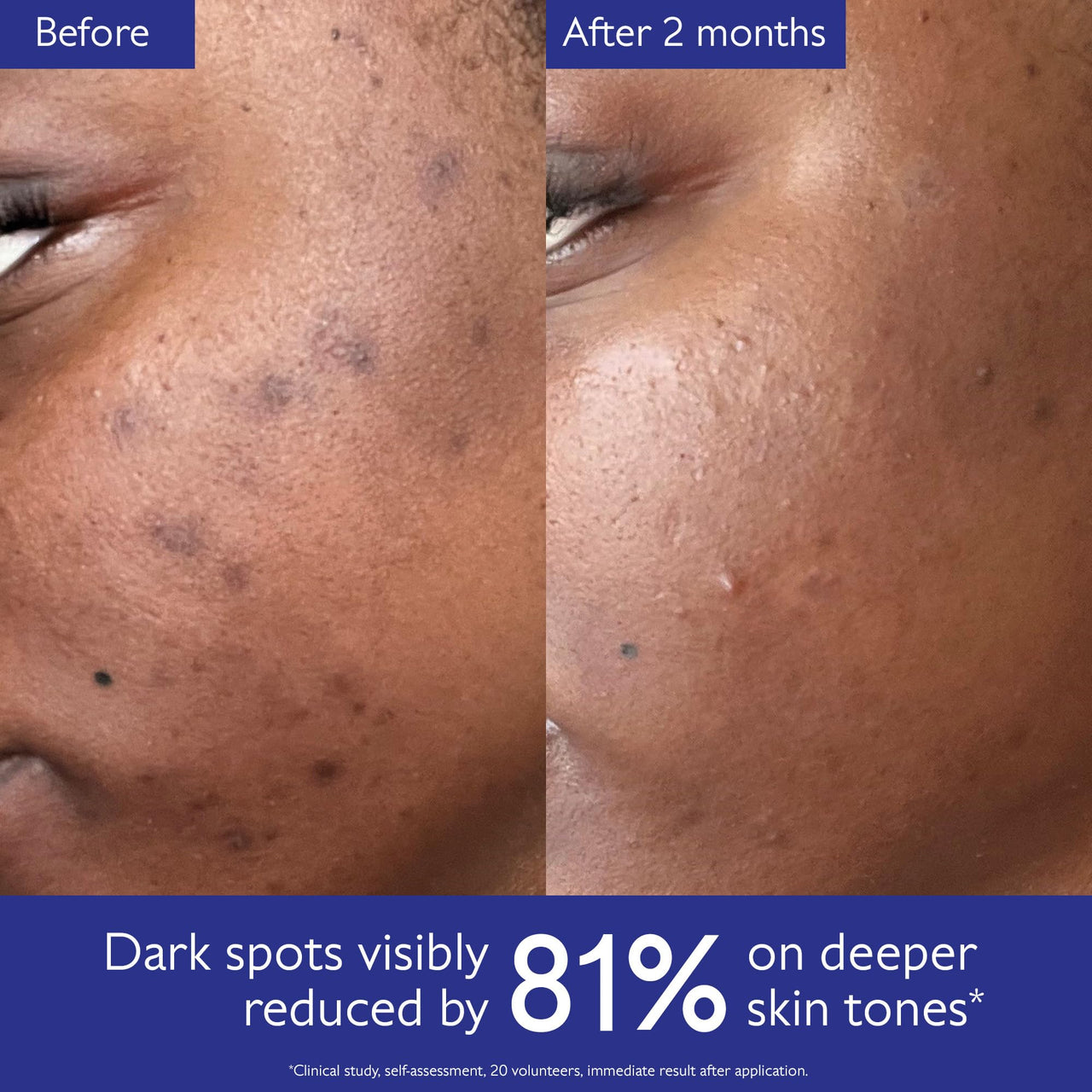 Caudalie Vinoperfect Brightening Dark Spot Serum Vitamin C Alternative - 62x More Effective than Vitamin C with Viniferine for a Visibly Brighter Even Complexion, 30 mL