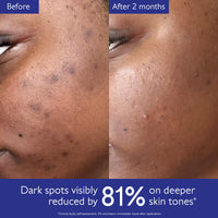 Thumbnail for Caudalie Vinoperfect Brightening Dark Spot Serum Vitamin C Alternative - 62x More Effective than Vitamin C with Viniferine for a Visibly Brighter Even Complexion, 30 mL