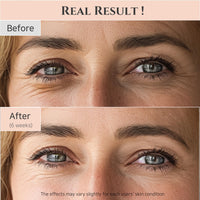 Thumbnail for Beauty of Joseon Revive Eye Serum with Retinal Niacinamide Correction for Puffy Eye Bags Fine Lines Dark Circles Wrinkles, Korean Skin Care 30ml, 1 fl.oz