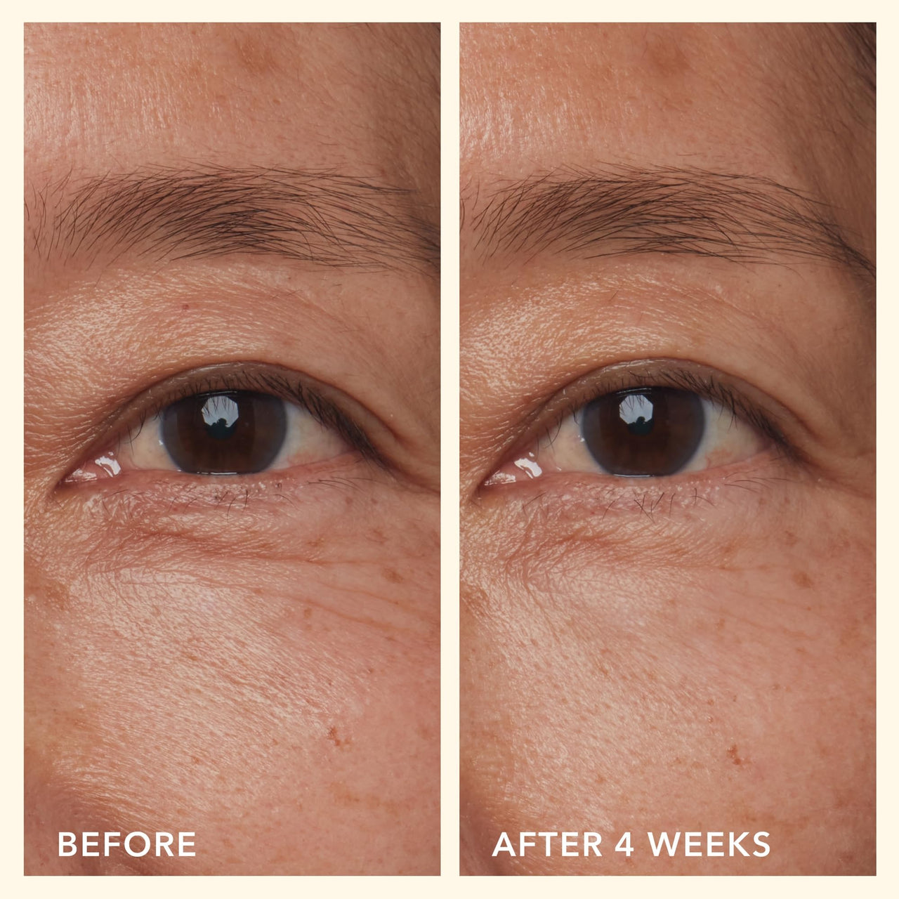 Beekman 1802 Mushroom Goat Milk Eye Cream - Clinically Proven Anti-Aging Eye Treatment for Dark Circles & Fine Lines - With Kojic Acid, Hexapeptide & Mushrooms - Fragrance-Free, Cruelty-Free