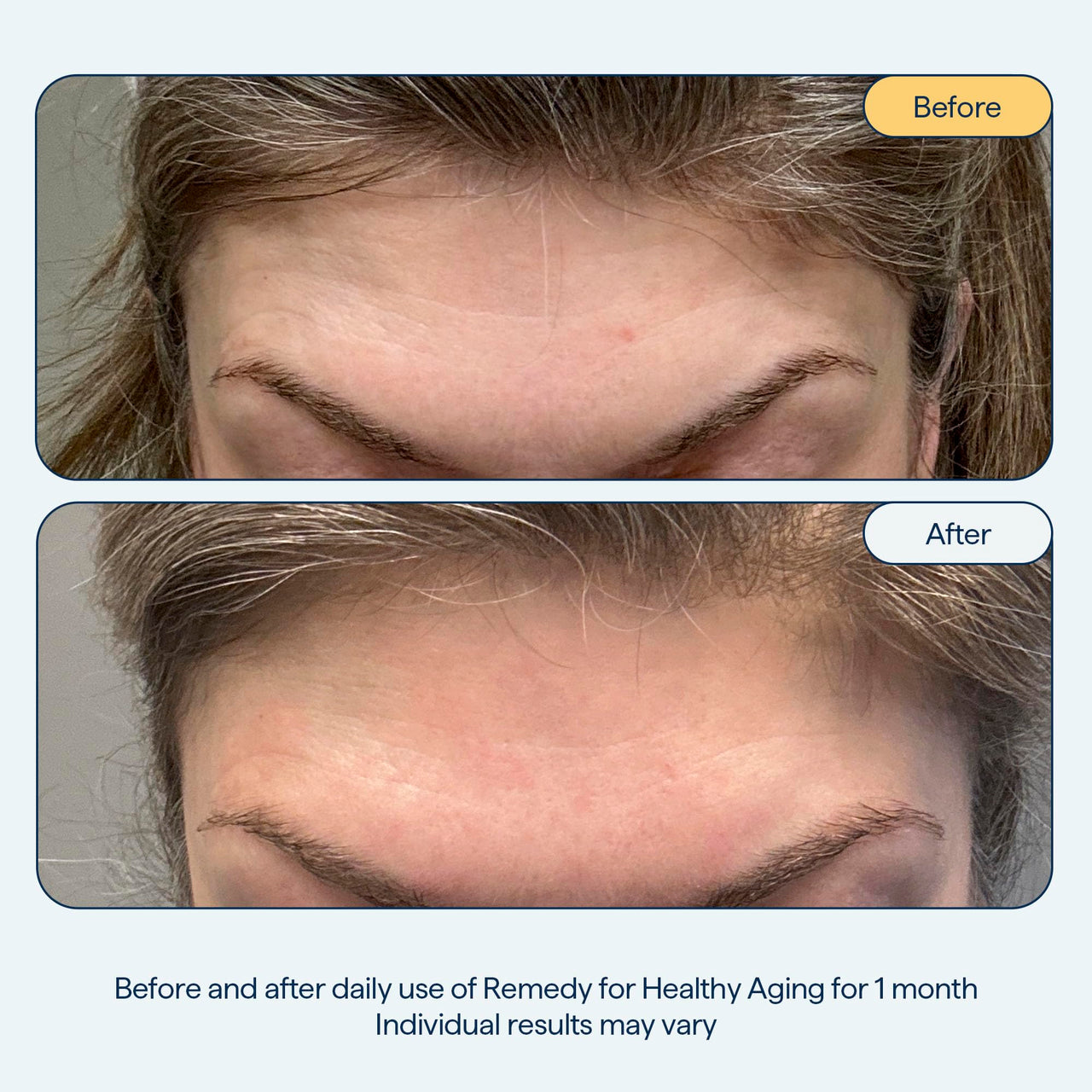 Dr. Shah's Dermatologist Bundle: 2x Remedy for Healthy Aging | Retinaldehyde, Argireline, Matrixyl 3000 & Glycolic Acid for Wrinkles + 1x Remedy for Dry Lips | Ceramides & Peptides for Cracked Lips