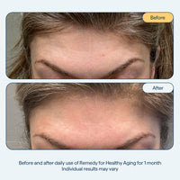 Thumbnail for Dr. Shah's Dermatologist Bundle: 2x Remedy for Healthy Aging | Retinaldehyde, Argireline, Matrixyl 3000 & Glycolic Acid for Wrinkles + 1x Remedy for Dry Lips | Ceramides & Peptides for Cracked Lips