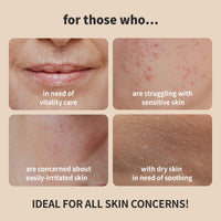 Thumbnail for BENTON Snail Bee High Content Skin (Toner) - Snail Mucin Toner, Snail Mucin Essence Toner, Bee Venom Korean Toner, Korean Skin Care Snail Toner, Face Skin Care Snail Essence, Snail Mucin Moisturizer
