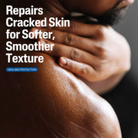 Thumbnail for Cetaphil Cracked Skin Repair Lotion, 16 oz, For Very Rough & Cracked, Sensitive Skin, 24 Hour Hydration, Protects & Hydrates Cracked Skin, Hypoallergenic, Fragrance Free