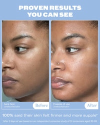 Thumbnail for Then I Met You Renewing Rich Beauty Cream, Deep Hydration Korean Moisturizer with Quad Ginseng Complex, Fast Absorbing Vegan-Cruelty-Free Plant-Based Antioxidant, Alcohol Free Skincare for Exfoliated