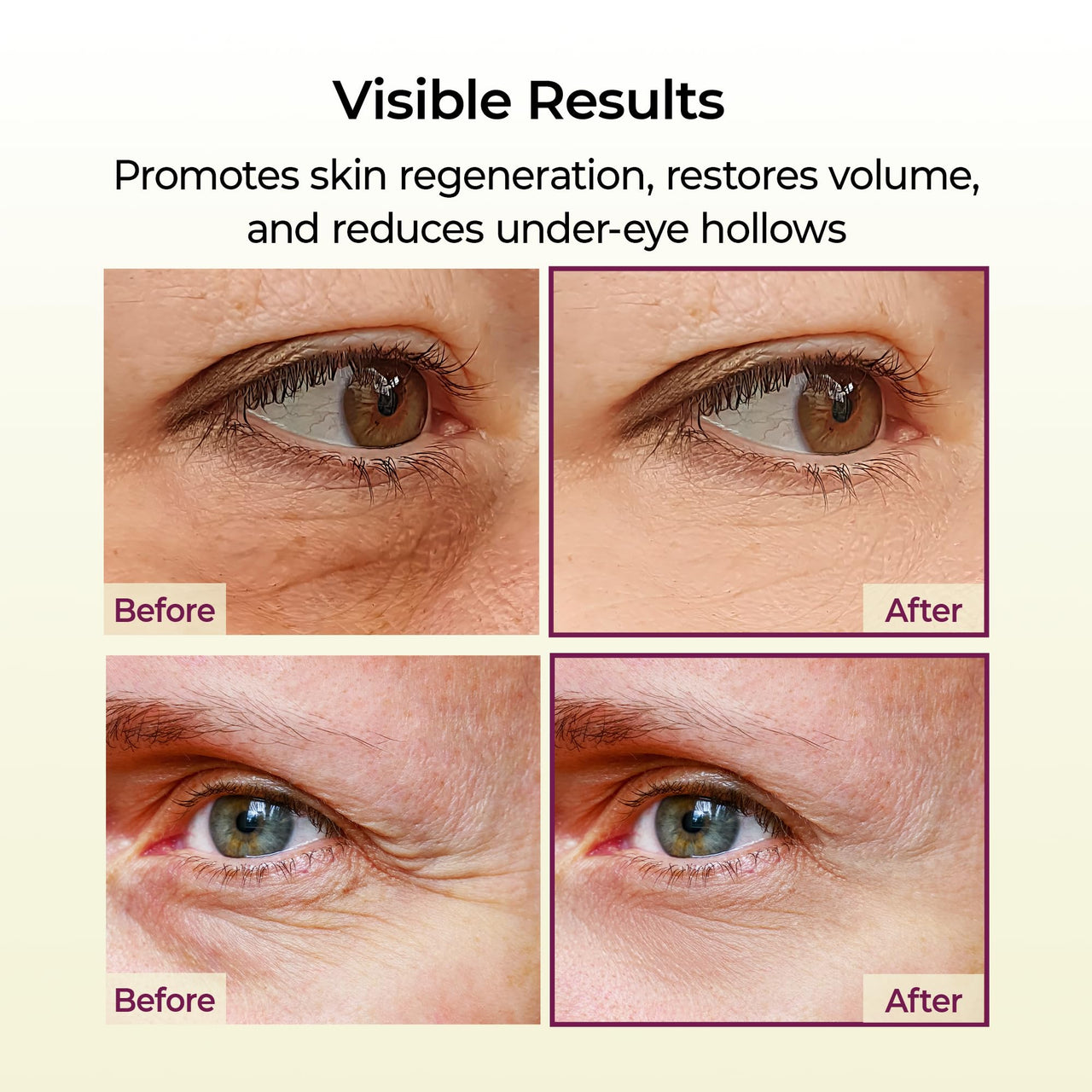 Dr.Melaxin Cemenrete Calcium Multi Balm 9g Korean Skin Care All In One Stick Collagen Face Eye treatment Balm