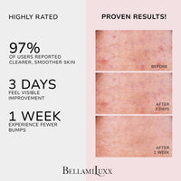 Thumbnail for BellamiLuxx Butt Acne Clearing Treatment Cream: Body Acne Treatment for Folliculitis and Pimples on Buttocks, Thighs, and Body with 2% Salicylic Acid & Tea Tree Oil - Butt Cream for Smooth Skin