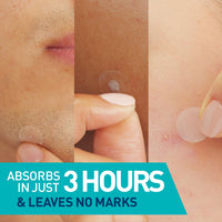 Thumbnail for CeraVe Hydrocolloid Blemish Patches, Oil Absorbing Spot Control with Ceramides and Niacinamide, Allergy-Tested & Suitable For Sensitive Skin, Ultra-Thin & Blends Into All Skin Tones, 22ct