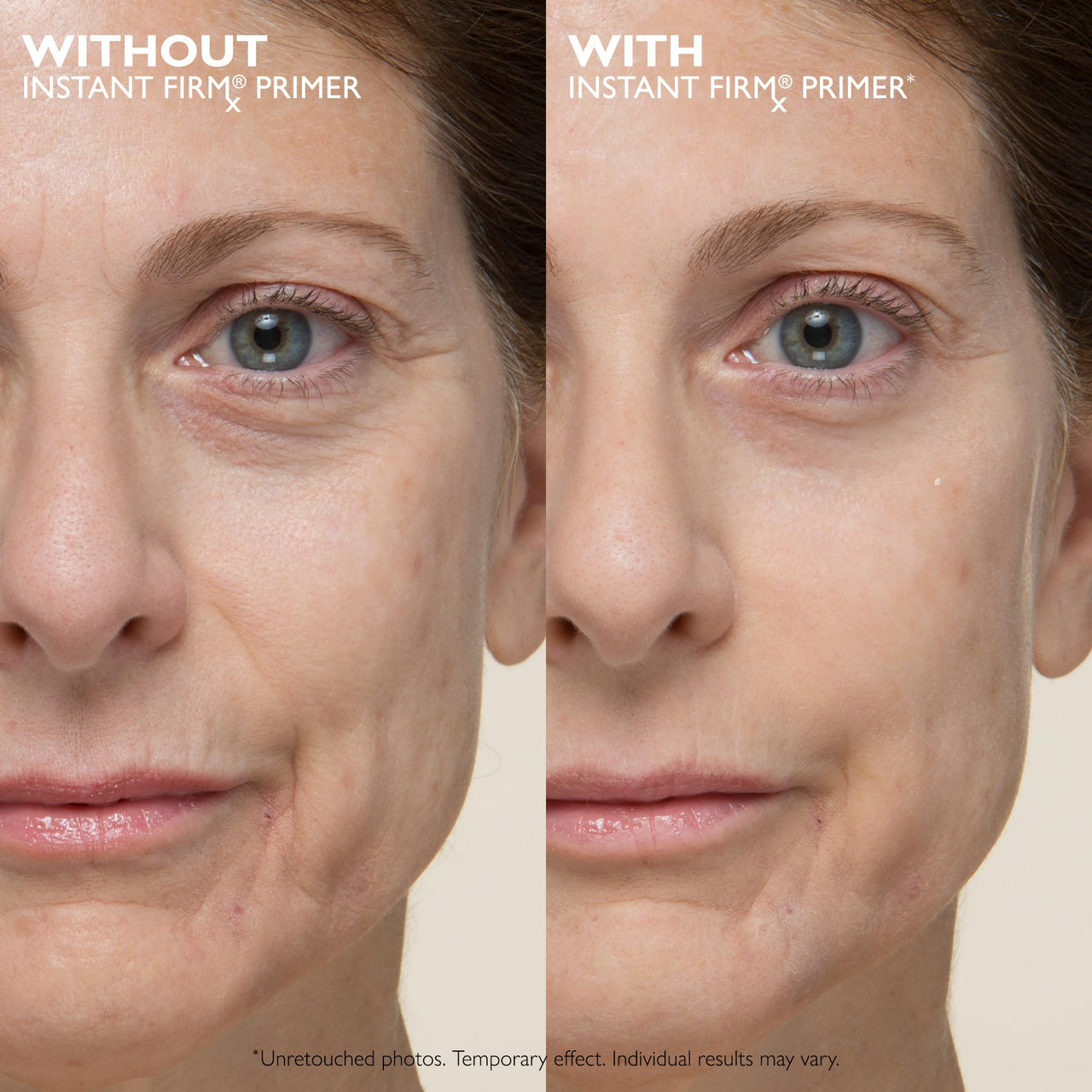 Peter Thomas Roth | Instant FIRMx® No-Filter Primer, Instant Skin Tightener, Skin Firmer, Makeup Primer For Face, Blurring Face Primer