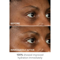 Thumbnail for Dr Dennis Gross DermInfusions Lift + Repair Eye Mask | Visibily Lift + Firm, Fills the Appearance of Fine Lines, Deepy Hydrates + Repairs, Visibly Depuffs the Undereye Area | 4 Treatments