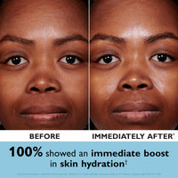 Thumbnail for Peter Thomas Roth | Water Drench® Hyaluronic Cloud Cream Hydrating Refillable Moisturizer | Hyaluronic Acid Cream For All Skin Types, Line-Smoothing, Fragrance-Free