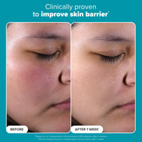 Thumbnail for Paula's Choice SKIN PERFECTING 2% BHA Liquid Salicylic Acid Exfoliant-Facial Exfoliant for Blackheads, Enlarged Pores, Wrinkles & Fine Lines