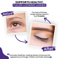 Thumbnail for RapidLash Eyelash Enhancing Serum with HEXATEIN 1 Complex – Lash Serum for Eyelashes Conditioning & Hydrating – Longer-Looking, Fuller and Thicker Appearing Lashes – 3 mL / 0.1 fl oz