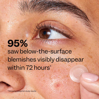 Thumbnail for Peach Slices - Deep Blemish Microdarts (9 ct) - Early Stage Pimple Patches for Face - Salicylic Acid, Niacinamide, Hyaluronic Acid, Tea Tree Oil & Cica - Vegan, Cruelty Free, Korean Skin Care & Beauty