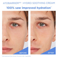 Thumbnail for AESTURA ATOBARRIER365 Hydro Soothing Gel Cream Moisturizer with Ceramides for Moisture Barrier Repair | Lightweight Hydration, Instant Cooling, Suitable for Sensitive Skin, 60ML / 2.03 fl.oz.