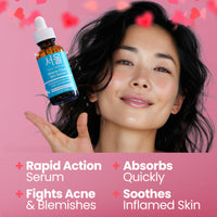 Thumbnail for SeoulCeuticals Korean Acne Serum, Skin Care Treatment for Acne Prone Skin - Rapid Action Salicylic Acid, Tea Tree & Clove For Even Skin Tone 1oz