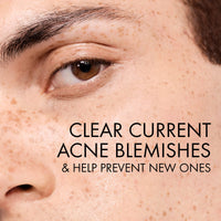 Thumbnail for VICHY Normaderm Daily Acne Face Wash, 0.5% Salicylic Acid Cleanser, Gel Cleanser For Oily Skin, Removes Excess Oil, Dirt & Clogged Pores, Oil Free Acne Wash, Soap & Sulfate Free, Non-Drying