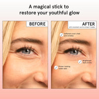 Thumbnail for grace & stella Under Eye Brightener Balm Stick - Caffeine Eye Cream for Dark Circles, Puffiness, Wrinkles - Moisturizer Stick with Niacinamide, Hyaluronic Acid, Peptides - Vegan Skincare (0.13oz/3.5g)