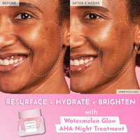 Thumbnail for Glow Recipe Watermelon Glow AHA Night Treatment - Overnight Resurfacing Mask with AHA Complex, Hyaluronic Acid, Niacinamide & Watermelon Enzymes for Smooth, Glowing, Even-Toned Skin (60ml)