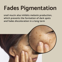 Thumbnail for IUNIK Black Snail Serum 70% w/Centella Asiatica Essence | Hydration Dark Spots Fine Lines | Oily Sensitive Acne-Prone Skin Korean Skincare No Pore Clogging