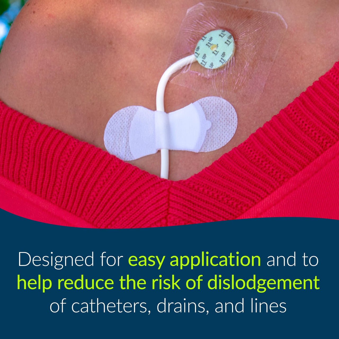 TIDI 3300M Grip-Lok Medium Securement Device ― Pack of 100 ― Catheter Stabilization Device ― White ― Flexible Material ― Low-Profile Design for Comfort― Home Healthcare ― Medical Supplies