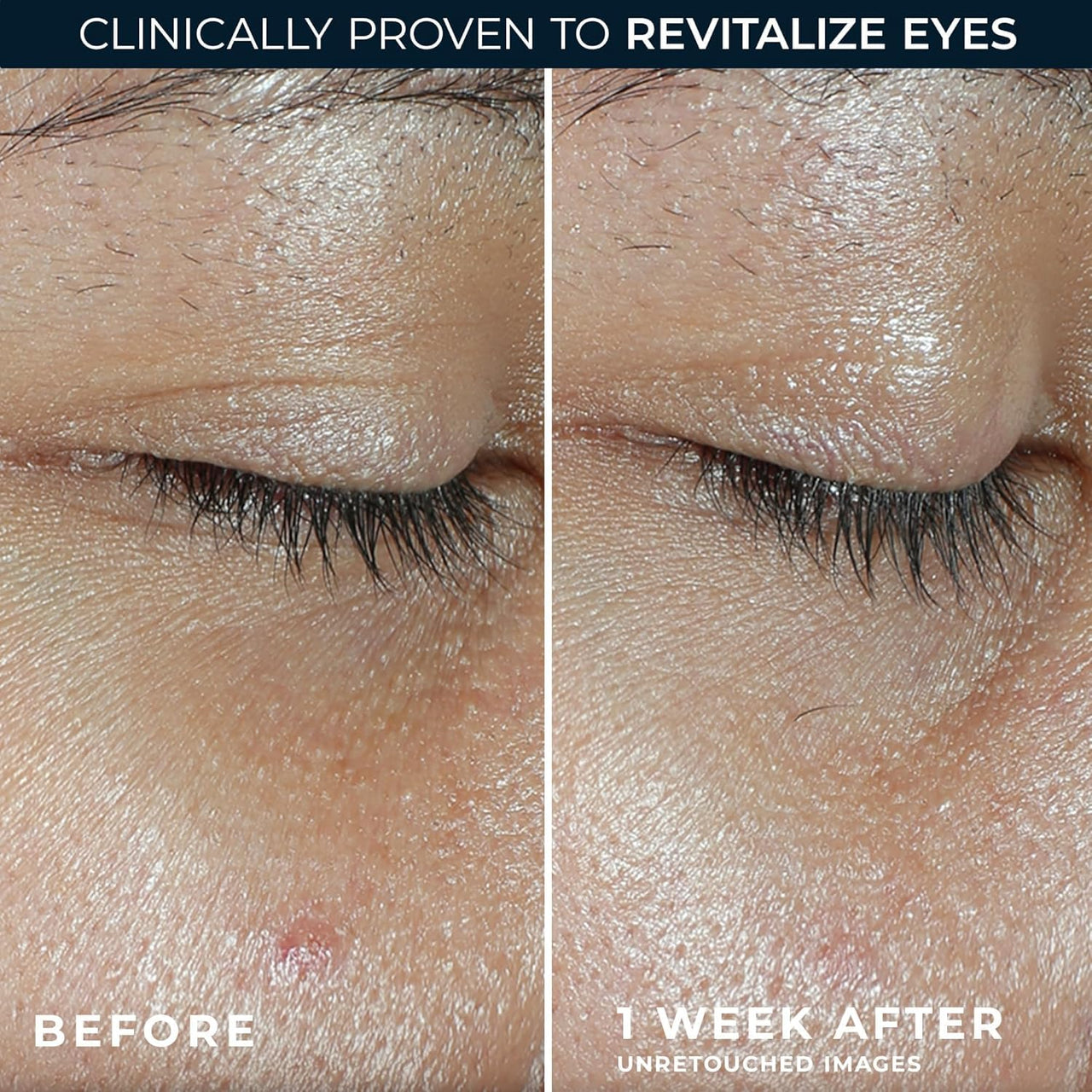 RoC Multi Correxion Revive + Glow Eye Balm with Vitamin C (0.14 oz) + Retinol Eye Cream Packette