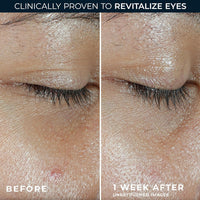 Thumbnail for RoC Multi Correxion Revive + Glow Eye Balm with Vitamin C (0.14 oz) + Retinol Eye Cream Packette